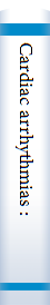 Cardiac arrhythmias :